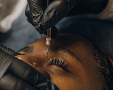 Squint management treatment at Susanjeevani Hospital, the top eye care hospital in Lucknow